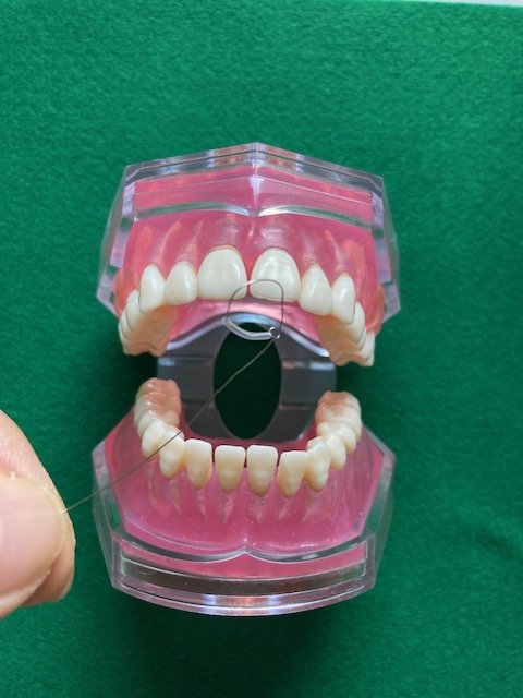 納棺師 必見：口閉じマジック!! - ツインズ 株式会社 - えどがわ産業ナビ