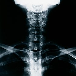 【命の危険】切削油の腐敗臭 吸引!! ニュース画像2