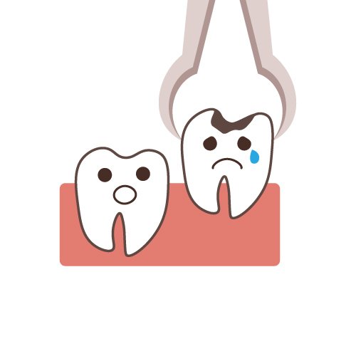 親知らずの抜歯は上と下どっちが痛い？ ニュース画像1