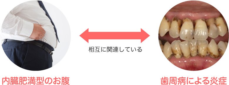 歯周病と糖尿病の密接な関係とは？相互作用と治療法 ニュース画像1