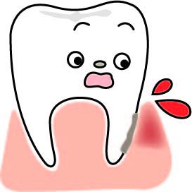 突然の歯茎の腫れにどう対応する？原因と治療法を解説 ニュース画像1