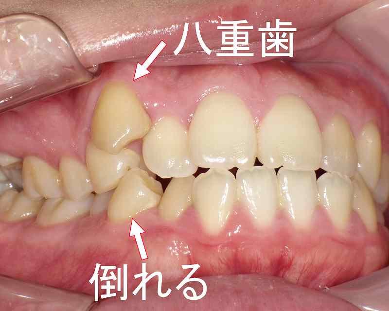 医療法人社団スマイル会 ふかさわ歯科クリニック篠崎 ニュース画像1