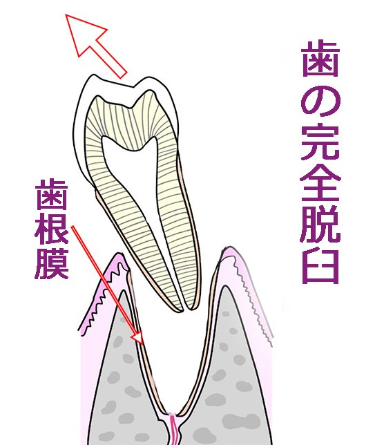 歯の脱臼とは？ぐらつきや抜けた歯を守るための正しい対応 ニュース画像1