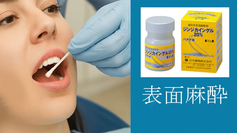 什么是表面麻醉？“温和麻醉”的故事，让你不再害怕牙医 新闻图片 1