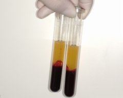 自分の血液で歯を治す？最新再生医療「CGF」解説！ ニュース画像1