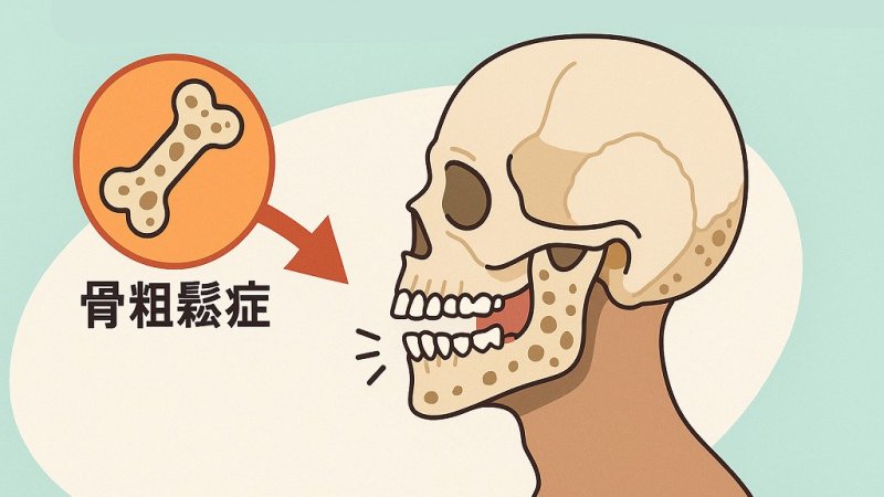 歯を守るには骨が大事？歯周病と骨粗鬆症の最新情報を解説 ニュース画像1