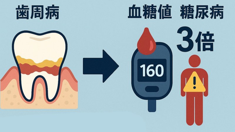 口の中から全身に影響？糖尿病と歯周病の相互関係を解説 ニュース画像1