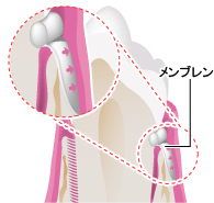 歯周病で失った骨を再生！GTR法の効果と手術の流れ ニュース画像1