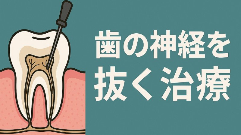 歯の神経を抜く治療｜痛みの有無・治療後の注意点 ニュース画像1