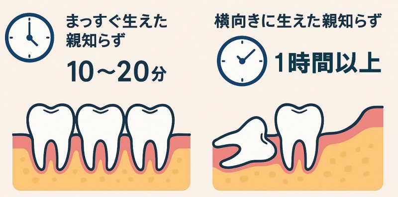 親知らずの抜歯にかかる時間はどれくらい？ケース別の目安 ニュース画像1