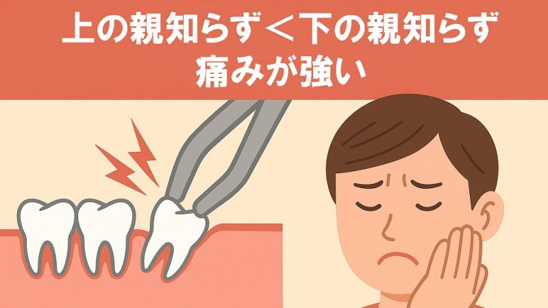親知らずの抜歯「上vs下」比較|下が痛い理由と術後ケア ニュース画像1