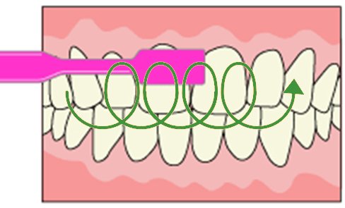 フォーンズ法のやり方と効果｜子どもにおすすめの歯磨き法 ニュース画像1