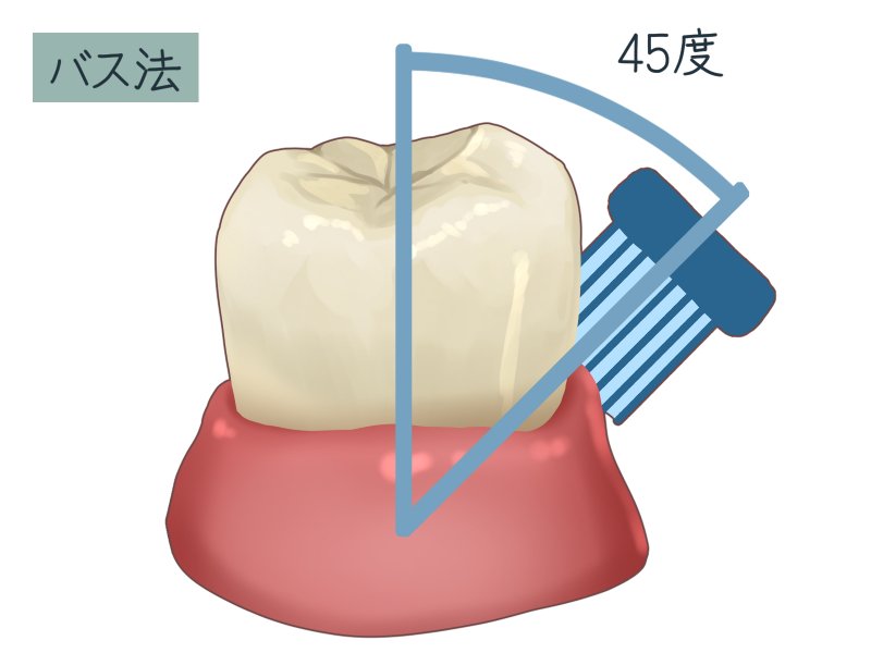 バス法 歯磨き｜歯周病・歯肉炎を防ぐ正しいやり方とコツ ニュース画像1