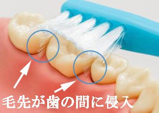 つまようじ法とは？正しいやり方と効果・おすすめ歯ブラシ ニュース画像1