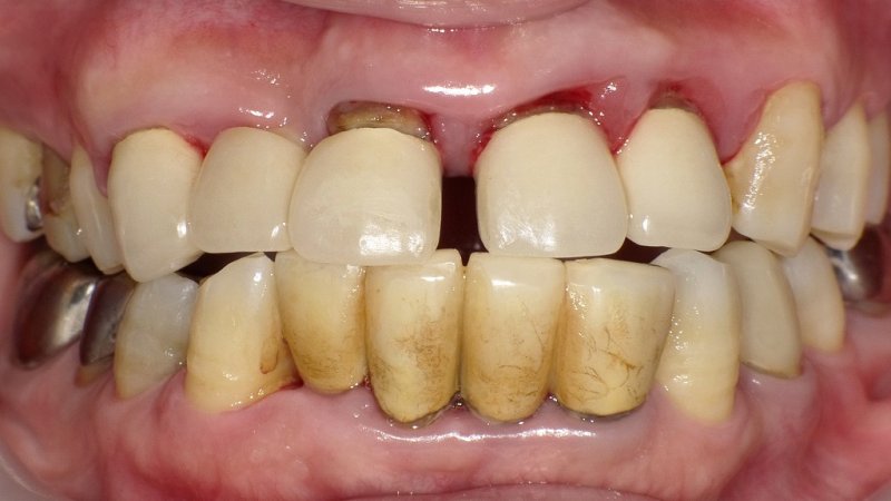 医療法人社団スマイル会 ふかさわ歯科クリニック篠崎 ニュース画像1