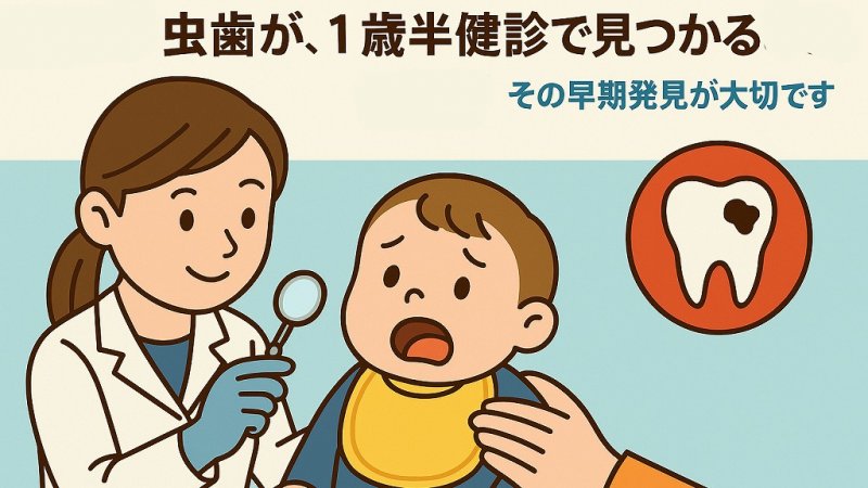 1歳半から始める虫歯予防と治療ガイド|小児歯科医が解説 ニュース画像1
