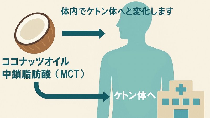 ブドウ糖代謝障害とケトン代謝:認知症とココナッツオイル ニュース画像1