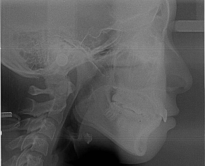 矯正治療のすべて|診断から治療・保定までの完全ガイド ニュース画像1
