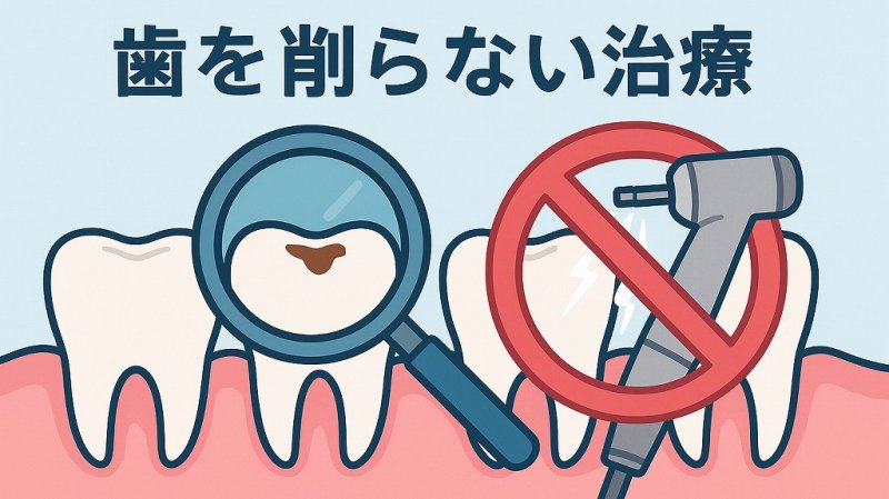歯をできるだけ削らない治療 ― 歯を守る低侵襲の選択肢 ニュース画像1