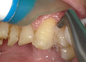 医療法人社団スマイル会 ふかさわ歯科クリニック篠崎 ニュース画像1
