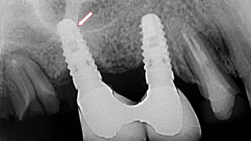 医療法人社団スマイル会 ふかさわ歯科クリニック篠崎 ニュース画像1