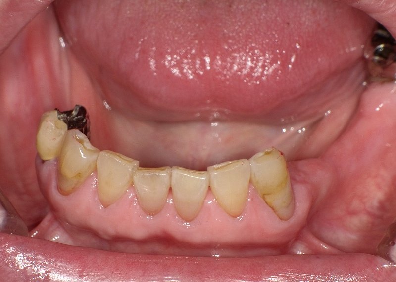 医療法人社団スマイル会 ふかさわ歯科クリニック篠崎 ニュース画像1