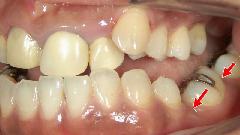 医療法人社団スマイル会 ふかさわ歯科クリニック篠崎 ニュース画像1