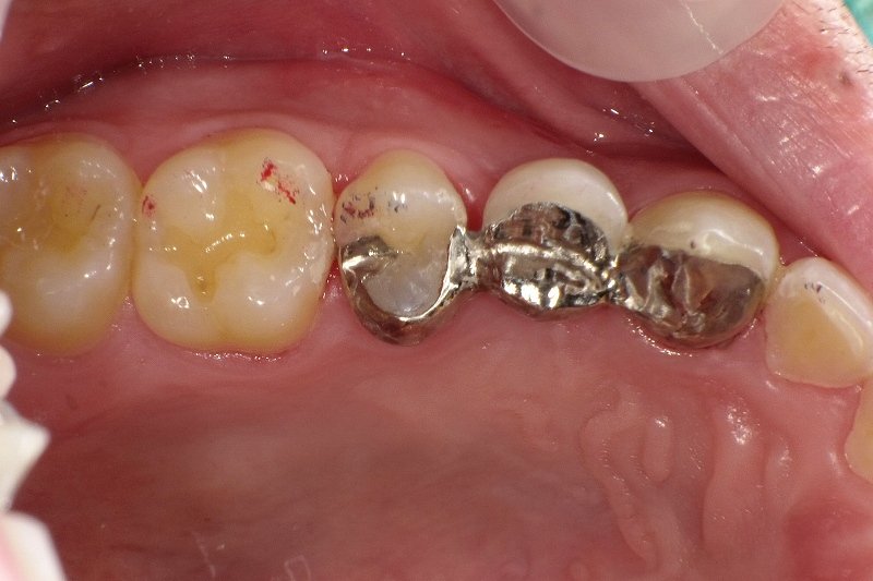 医療法人社団スマイル会 ふかさわ歯科クリニック篠崎 ニュース画像1