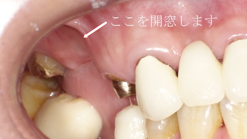 医療法人社団スマイル会 ふかさわ歯科クリニック篠崎 ニュース画像1