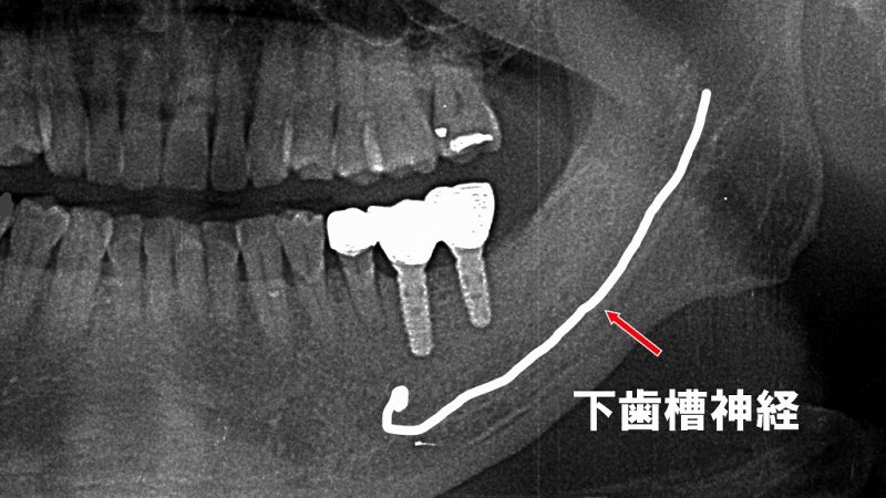 医療法人社団スマイル会 ふかさわ歯科クリニック篠崎 ニュース画像1