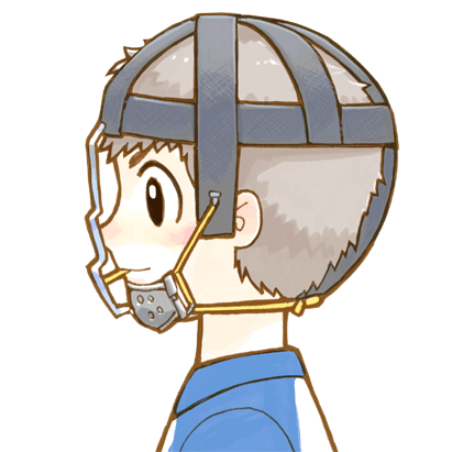 上顎前方牽引装置とは？受け口を骨格から改善する矯正治療 ニュース画像1