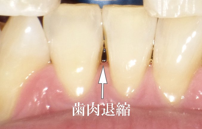 医療法人社団スマイル会 ふかさわ歯科クリニック篠崎 ニュース画像1