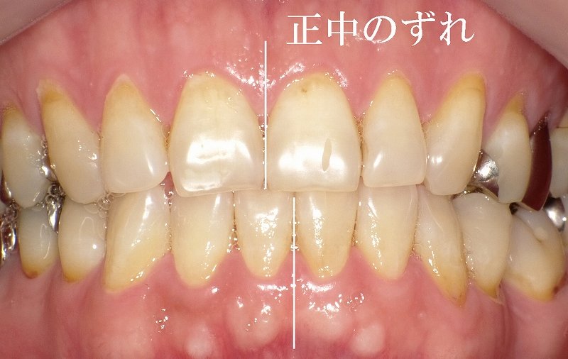 医療法人社団スマイル会 ふかさわ歯科クリニック篠崎 ニュース画像1