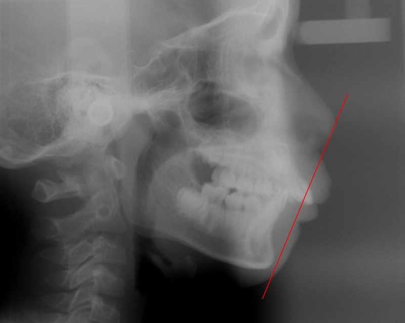 医療法人社団スマイル会 ふかさわ歯科クリニック篠崎 ニュース画像1