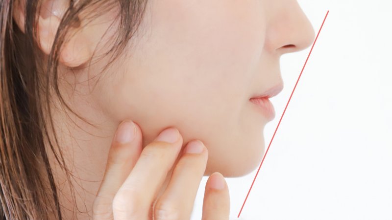 歯科医が解説するEラインとは?横顔美人の基準と改善方法 ニュース画像1