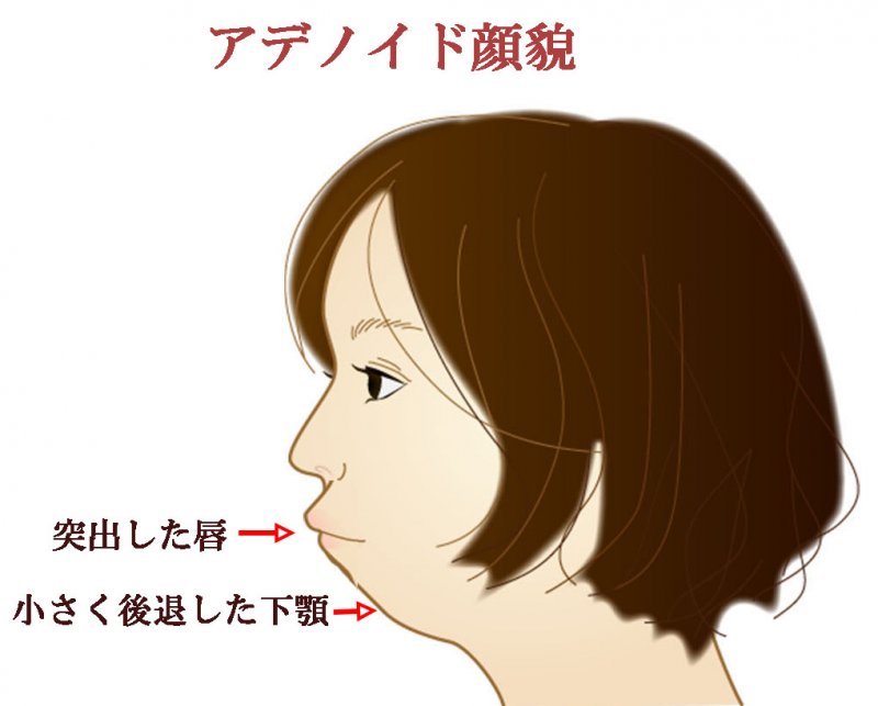 医療法人社団スマイル会 ふかさわ歯科クリニック篠崎 ニュース画像1