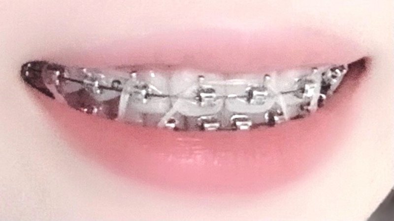 医療法人社団スマイル会 ふかさわ歯科クリニック篠崎 ニュース画像1