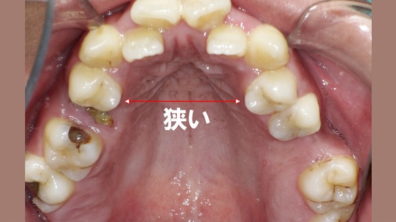 医療法人社団スマイル会 ふかさわ歯科クリニック篠崎 ニュース画像1