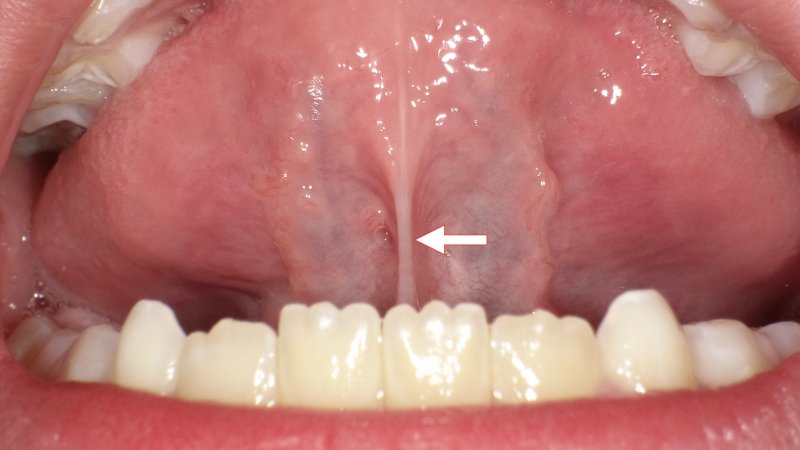 医療法人社団スマイル会 ふかさわ歯科クリニック篠崎 ニュース画像1