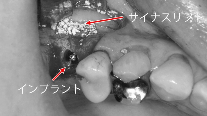 医療法人社団スマイル会 ふかさわ歯科クリニック篠崎 ニュース画像1
