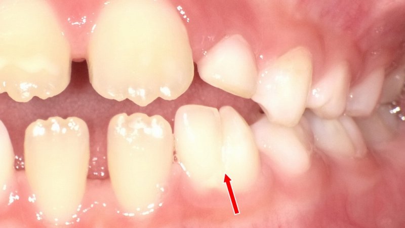 医療法人社団スマイル会 ふかさわ歯科クリニック篠崎 ニュース画像1
