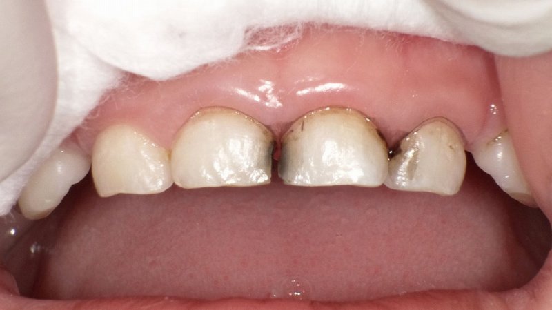 医療法人社団スマイル会 ふかさわ歯科クリニック篠崎 ニュース画像1