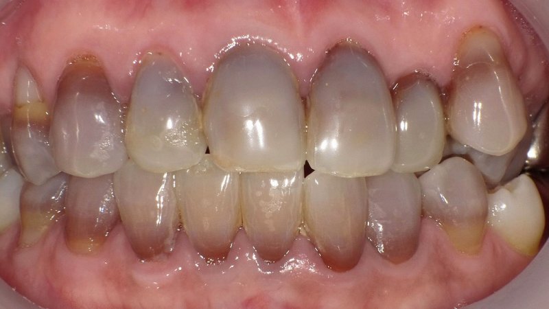 医療法人社団スマイル会 ふかさわ歯科クリニック篠崎 ニュース画像1