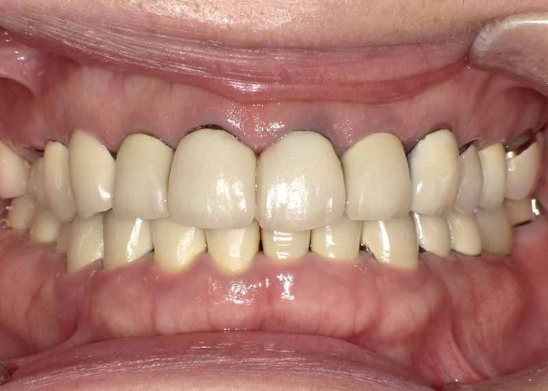 医療法人社団スマイル会 ふかさわ歯科クリニック篠崎 ニュース画像1