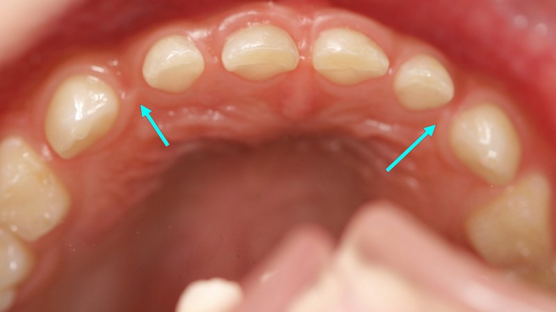 医療法人社団スマイル会 ふかさわ歯科クリニック篠崎 ニュース画像1