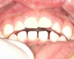 医療法人社団スマイル会 ふかさわ歯科クリニック篠崎 ニュース画像1