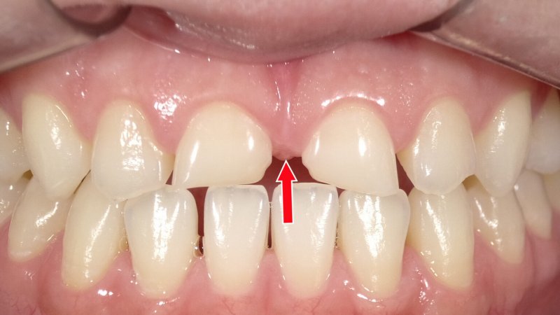 医療法人社団スマイル会 ふかさわ歯科クリニック篠崎 ニュース画像1