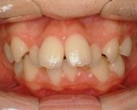 医療法人社団スマイル会 ふかさわ歯科クリニック篠崎 ニュース画像1