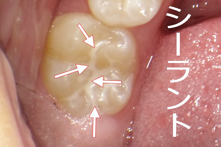 医療法人社団スマイル会 ふかさわ歯科クリニック篠崎 ニュース画像1