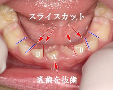 医療法人社団スマイル会 ふかさわ歯科クリニック篠崎 ニュース画像1